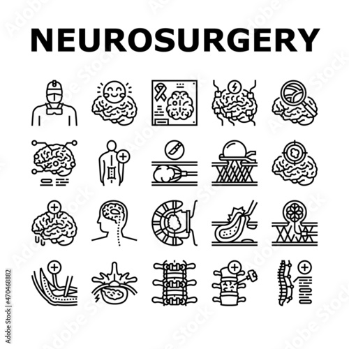 Neurosurgery Medical Treatment Icons Set Vector. Stereotactic Radiosurgery And Pediatric Neurosurgery, Neuro-oncology Researching, Coil Embolization And Spinal Surgery Black Contour Illustrations