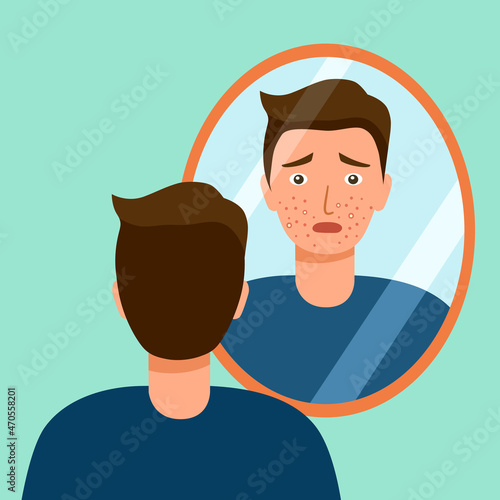 Young man looking in the mirror worrying about his acne on face in flat design. Pimple problem on male skin.