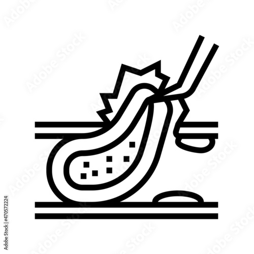 carotid endarterectomy line icon vector. carotid endarterectomy sign. isolated contour symbol black illustration
