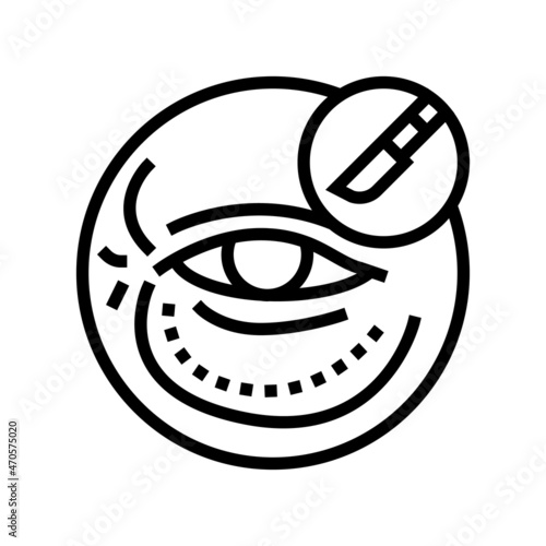 blepharoplasty surgery line icon vector. blepharoplasty surgery sign. isolated contour symbol black illustration