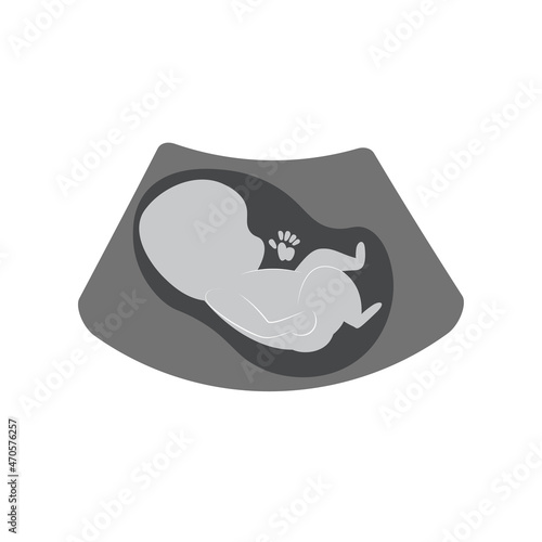 Simple illustration of ultra sound unborn baby on white background