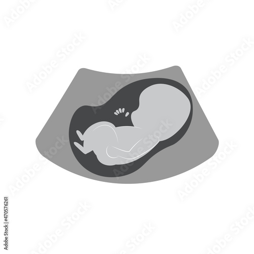Simple illustration of ultra sound unborn baby on white background