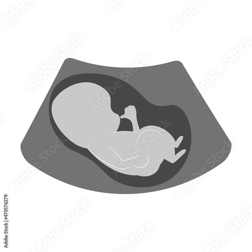 Simple illustration of ultra sound unborn baby on white background