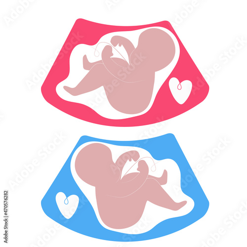 Simple illustration of ultrasound unborn baby girl and boy on white background with hearts