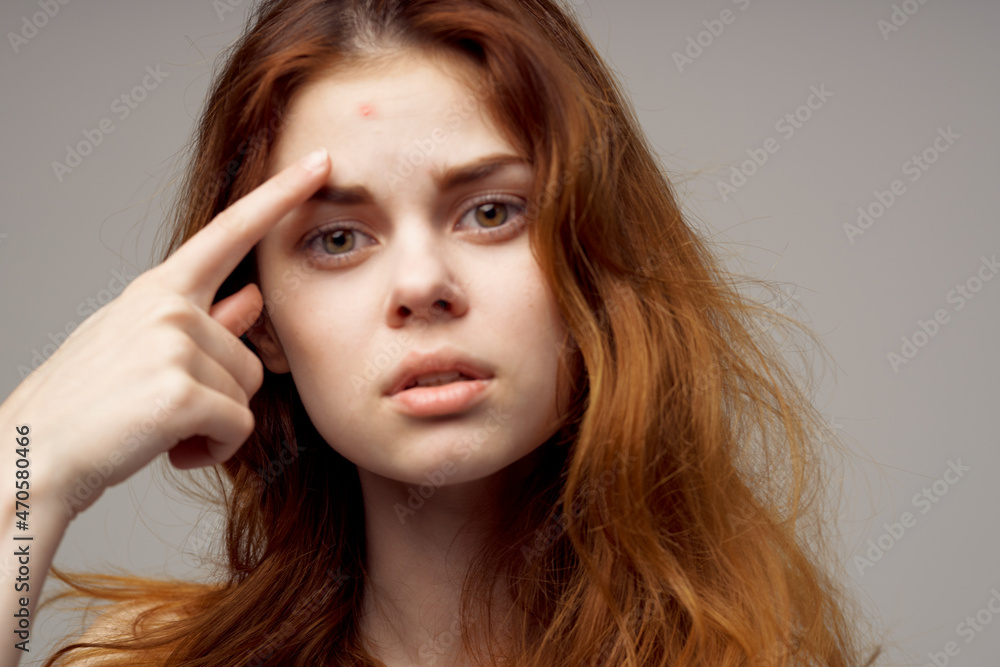 pretty woman facial skin problems dermatology close-up pretty woman facial skin problems dermatology close-up