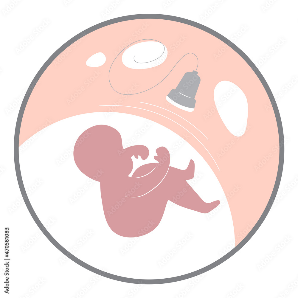 Simple illustration of ultrasound unborn baby in the circle Simple illustration of ultrasound unborn baby in the circle