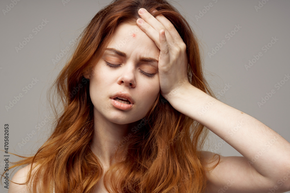 red-haired woman facial skin problems dermatology close-up red-haired woman facial skin problems dermatology close-up
