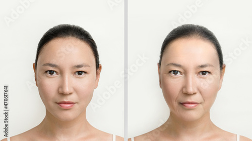 female face of asian woman, concept of aging before and after. skin care, prolongation of youth. female cosmetology. skin wrinkles