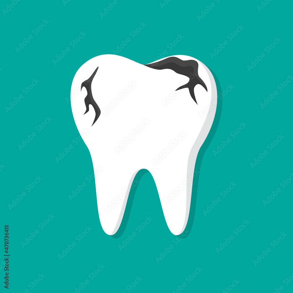 Tooth decay. Caries and disease of tooth. Icon of broken teeth. Flat illustration for care and healthy of teeth and cavity. Ache in bad mouth. Concept of toothache for protection and hygiene. Vector Tooth decay. Caries and disease of tooth. Icon of broken teeth. Flat illustration for care and healthy of teeth and cavity. Ache in bad mouth. Concept of toothache for protection and hygiene. Vector