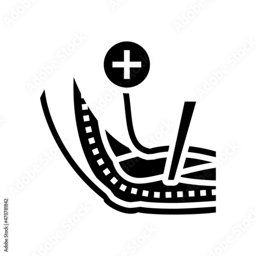 ulnar nerve release glyph icon vector. ulnar nerve release sign. isolated contour symbol black illustration
