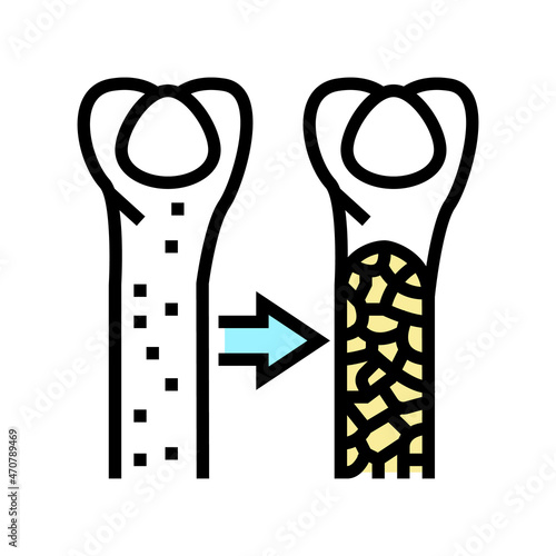 osteoporosis bone disease color icon vector. osteoporosis bone disease sign. isolated symbol illustration
