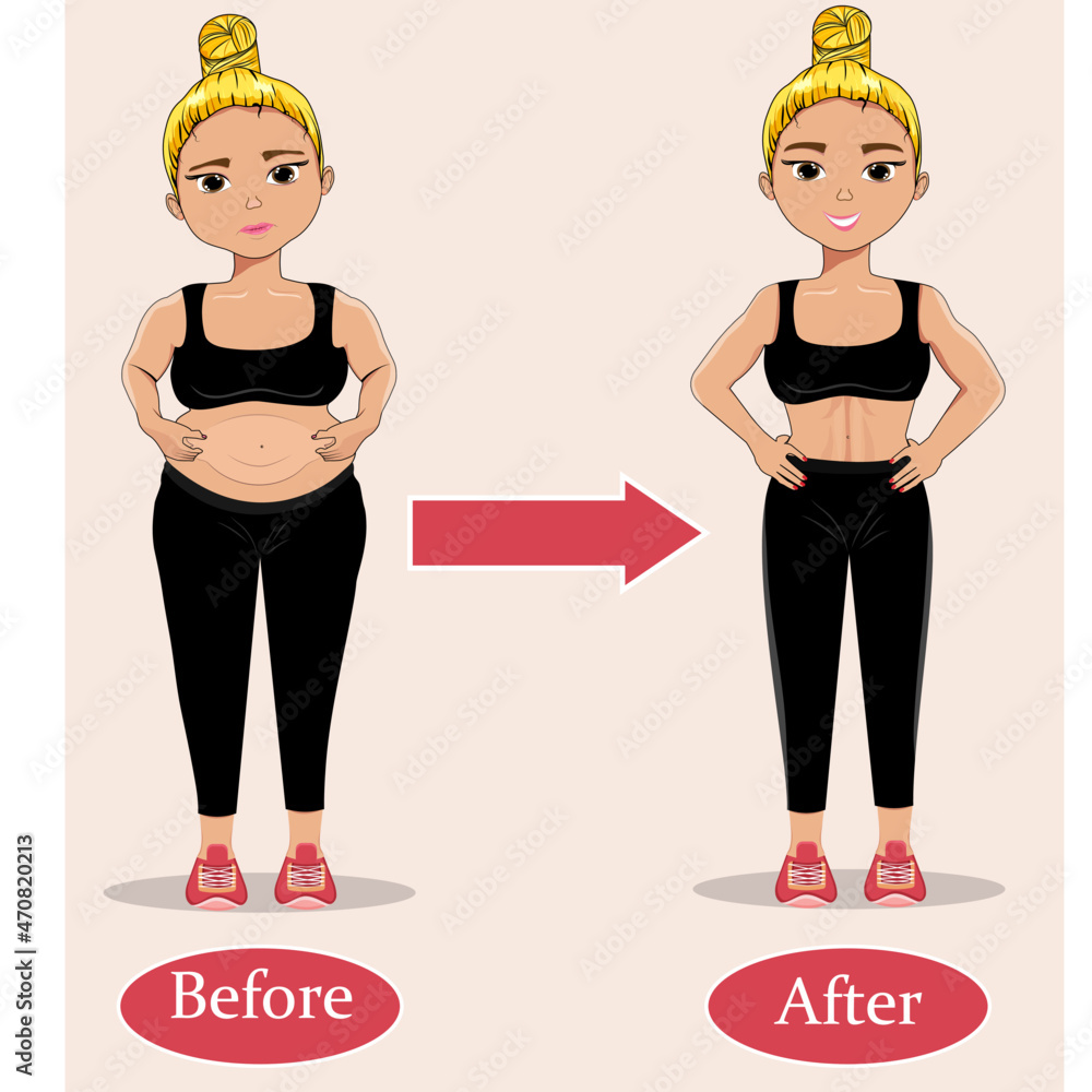 The girl is thick and thin. Before and after. Flat style. Healthy  lifestyle. Slimming. Transformation. After exercise. Cartoon. Stock Vector  illustration. Comparison. Gym. Workout. Sport. Stock Vector | Adobe Stock