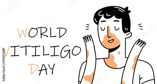 World vitiligo day banner or poster with happy young man. Character with vitiligo. Vector illustration.