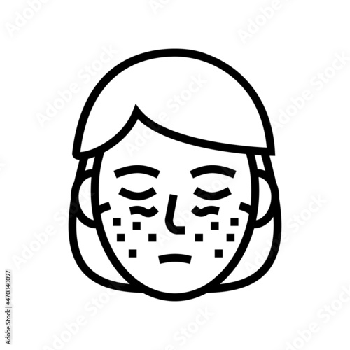systemic lupus erythematosus line icon vector. systemic lupus erythematosus sign. isolated contour symbol black illustration