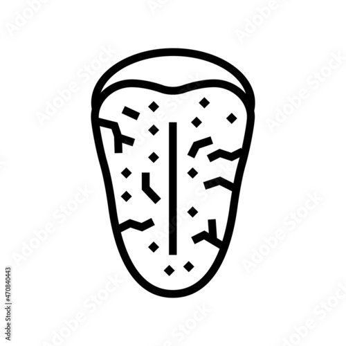 sjogrens syndrome line icon vector. sjogrens syndrome sign. isolated contour symbol black illustration photo