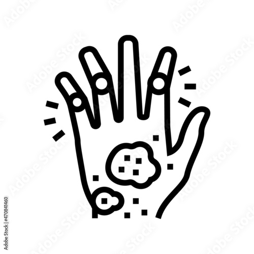 psoriatic arthritis skin health problem line icon vector. psoriatic arthritis skin health problem sign. isolated contour symbol black illustration