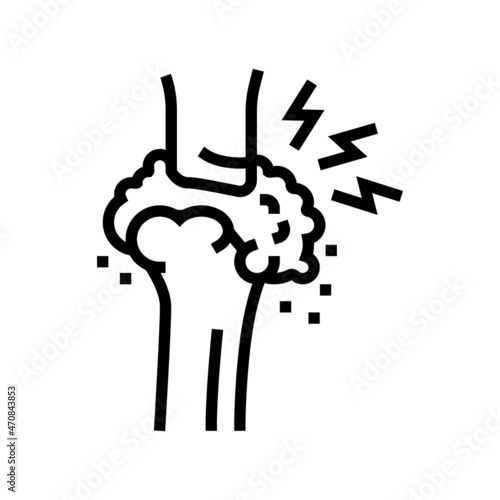 gout health problem line icon vector. gout health problem sign. isolated contour symbol black illustration