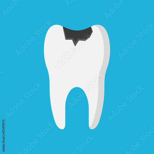 Tooth caries flat vector illustration. Decay tooth. Isolated vector design. Flat design.