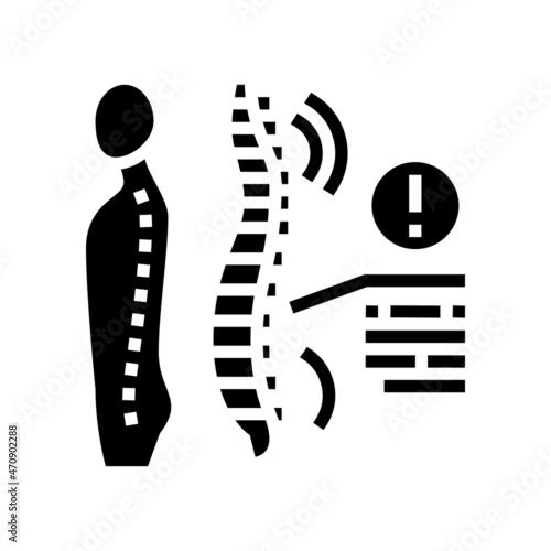spondyloarthropathies health problem glyph icon vector. spondyloarthropathies health problem sign. isolated contour symbol black illustration