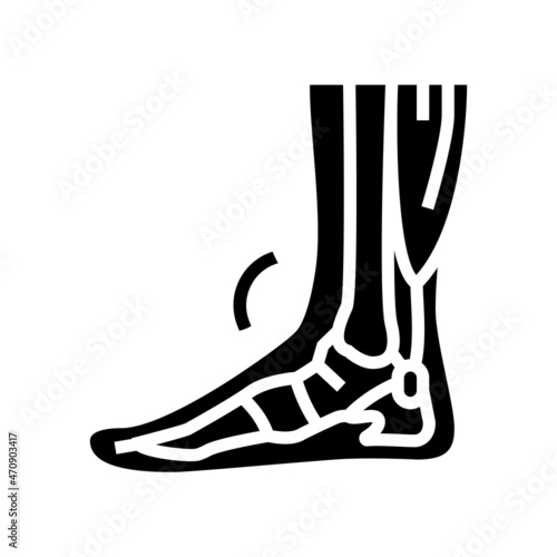 tendonitis problem glyph icon vector. tendonitis problem sign. isolated contour symbol black illustration