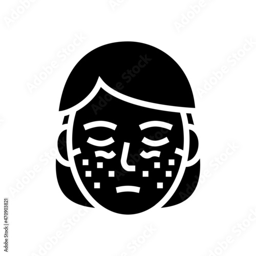systemic lupus erythematosus glyph icon vector. systemic lupus erythematosus sign. isolated contour symbol black illustration