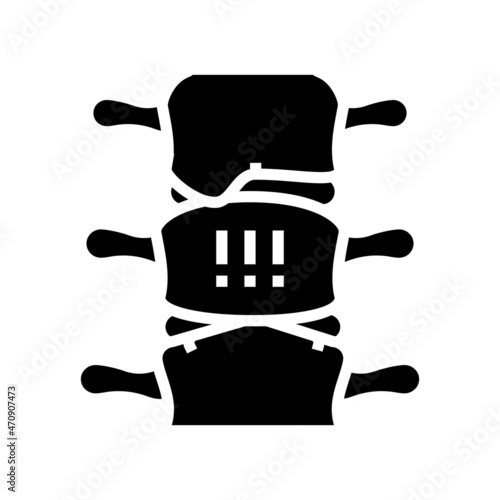 ankylosing spondylitis glyph icon vector. ankylosing spondylitis sign. isolated contour symbol black illustration