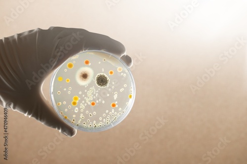 Antimicrobial susceptibility resistance test by diffusion in hands photo