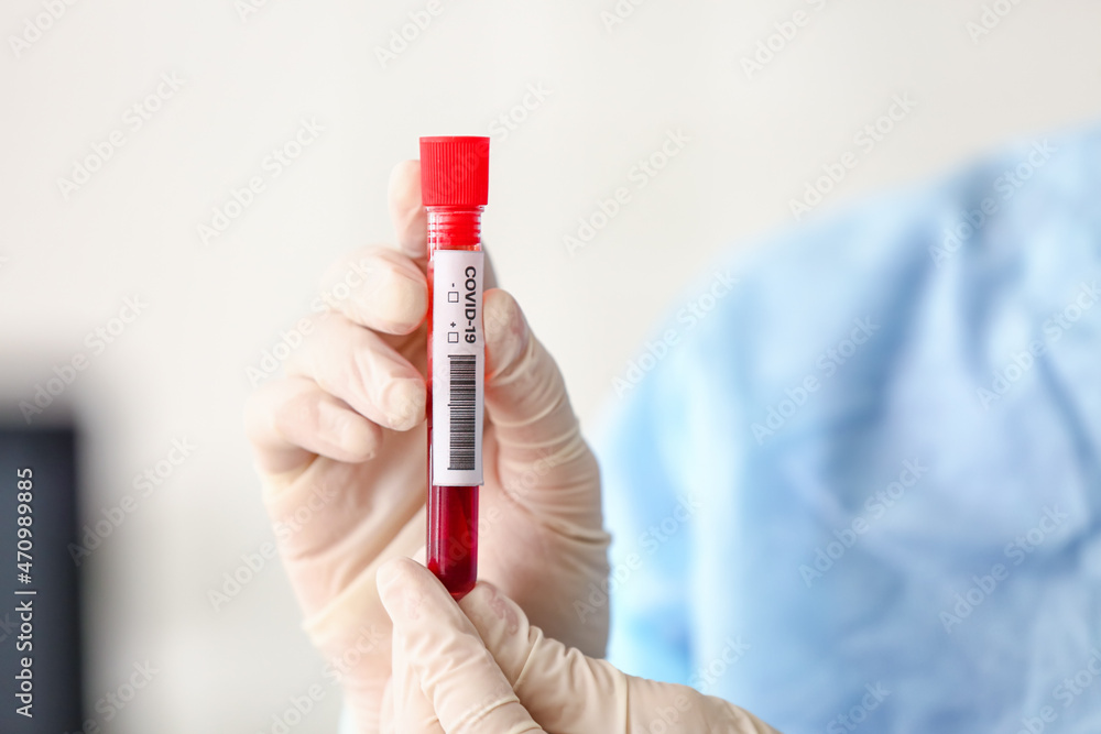 Scientist with sample of covid-19 in laboratory Scientist with sample of covid-19 in laboratory