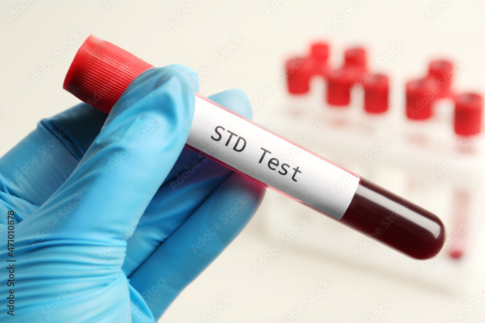 Fototapeta premium Scientist holding tube with blood sample and label STD Test on blurred background, closeup