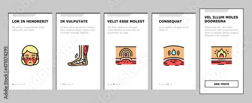 Rheumatology Disease Problem Onboarding Mobile App Page Screen Vector. Ankylosing Spondylitis And Polymyalgia Rheumatica Polymyositis Muscle Osteoporosis Bone Ill Rheaumatology Treatment Illustrations
