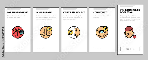 Otorhinolaryngology Treatment Onboarding Mobile App Page Screen Vector. Cholesteatoma And Hoarseness Health Problem, Rhinoplasty Surgery And Menieres Symptom Otorhinolaryngology Treat. Illustrations