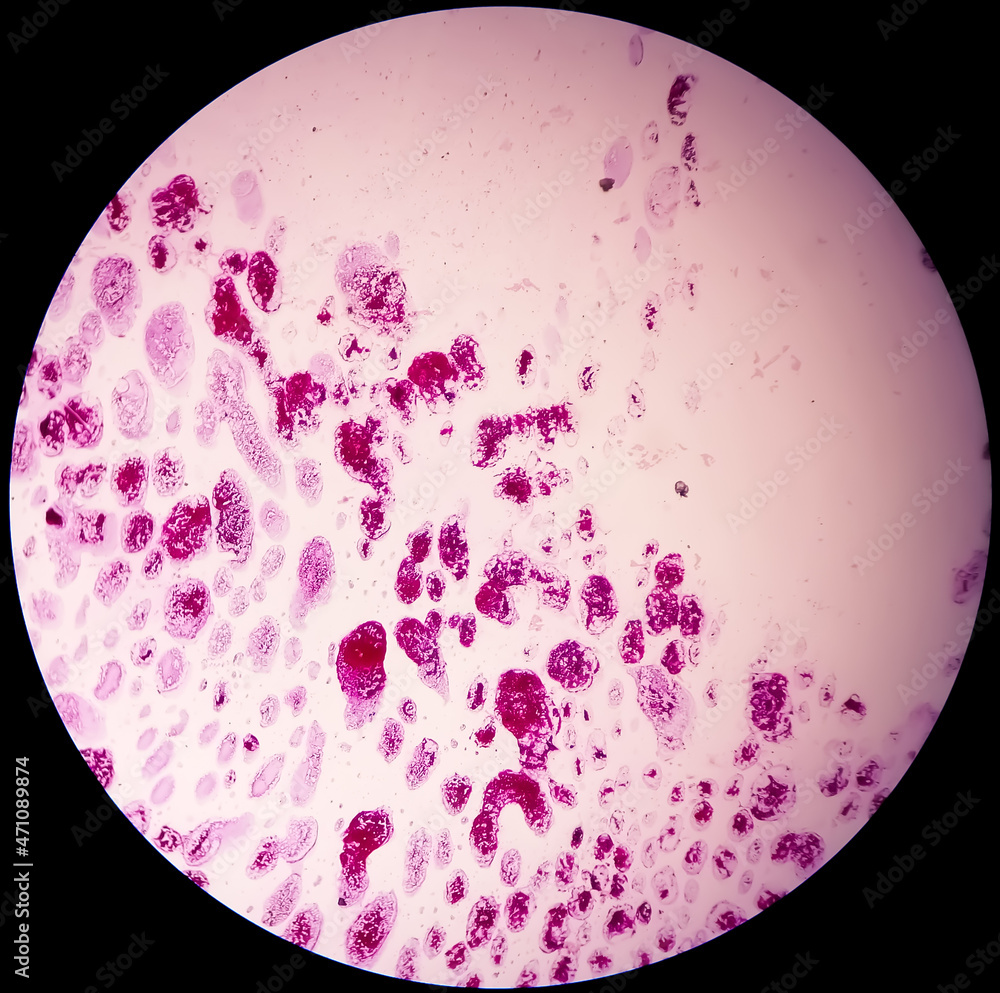 Gram staining, also known as Gram's method, is a method of