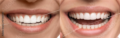 Collage with photos of woman using dental floss  closeup. Step by step instructions