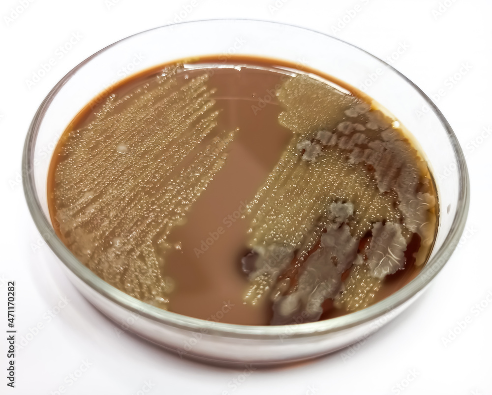 Staphylococcus aureus Grampositive bacteria, nonmotile, beta