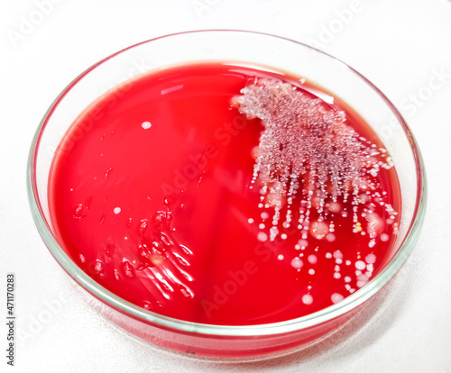 Staphylococcus aureus: Gram-positive bacteria, nonmotile, beta hemolysis, Staphylococcus growth on blood agar media photo