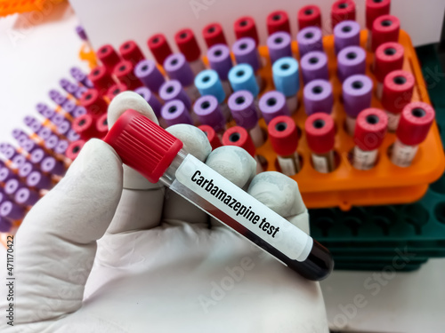 Blood sample for Carbamazepine test, to establish an appropriate dose and maintain a therapeutic level, laboratory background, focus view