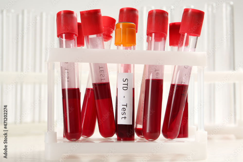 Tubes with blood samples in rack on white background. STD test - obrazy, fototapety, plakaty 