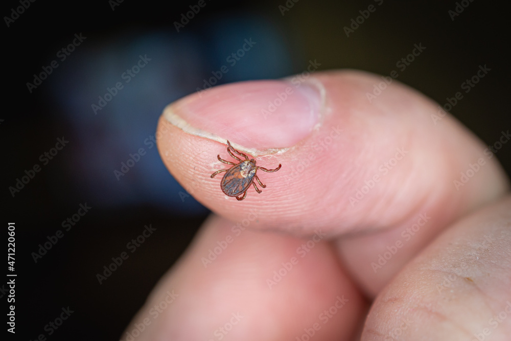 Obraz premium A tick on the hand, on the finger. Close-up.