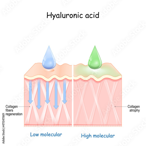 Hyaluronic acid. skin rejuvenation