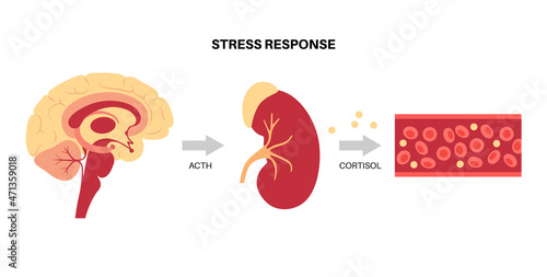 Stress responce system