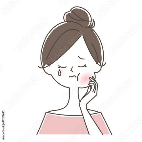 頬が腫れる女性