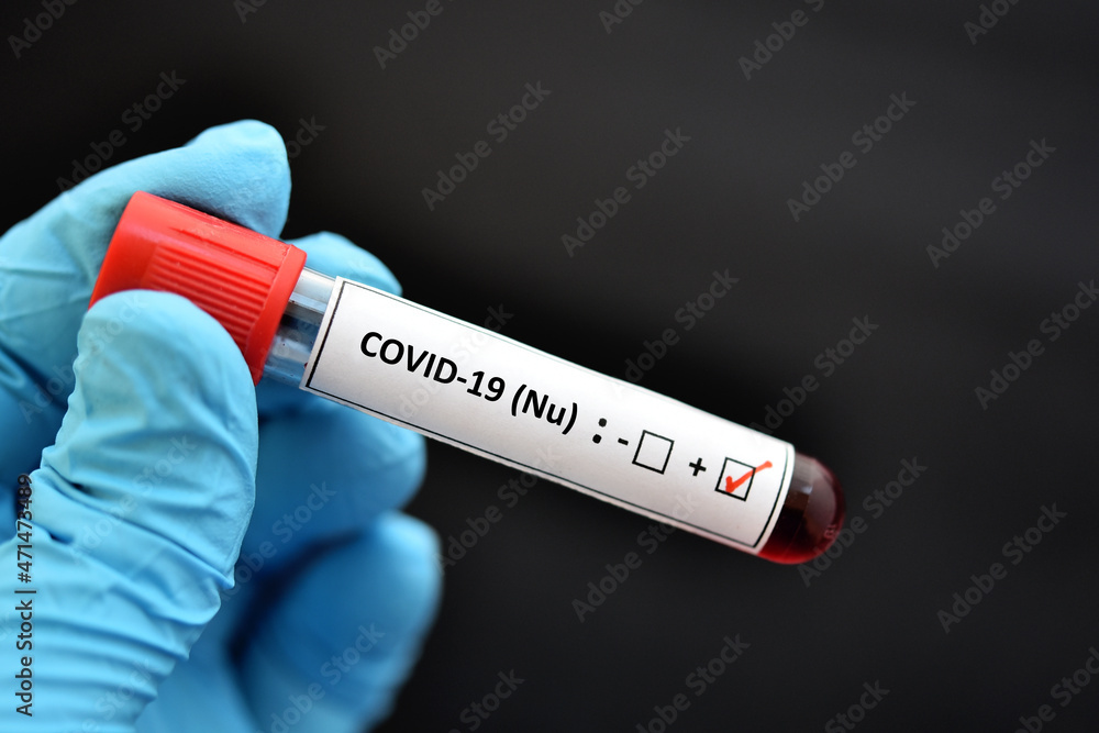 Obraz premium Nu variant COVID-19 positive, blood sample positive with Nu or B.1.1.529 variant of COVID-19 coronavirus