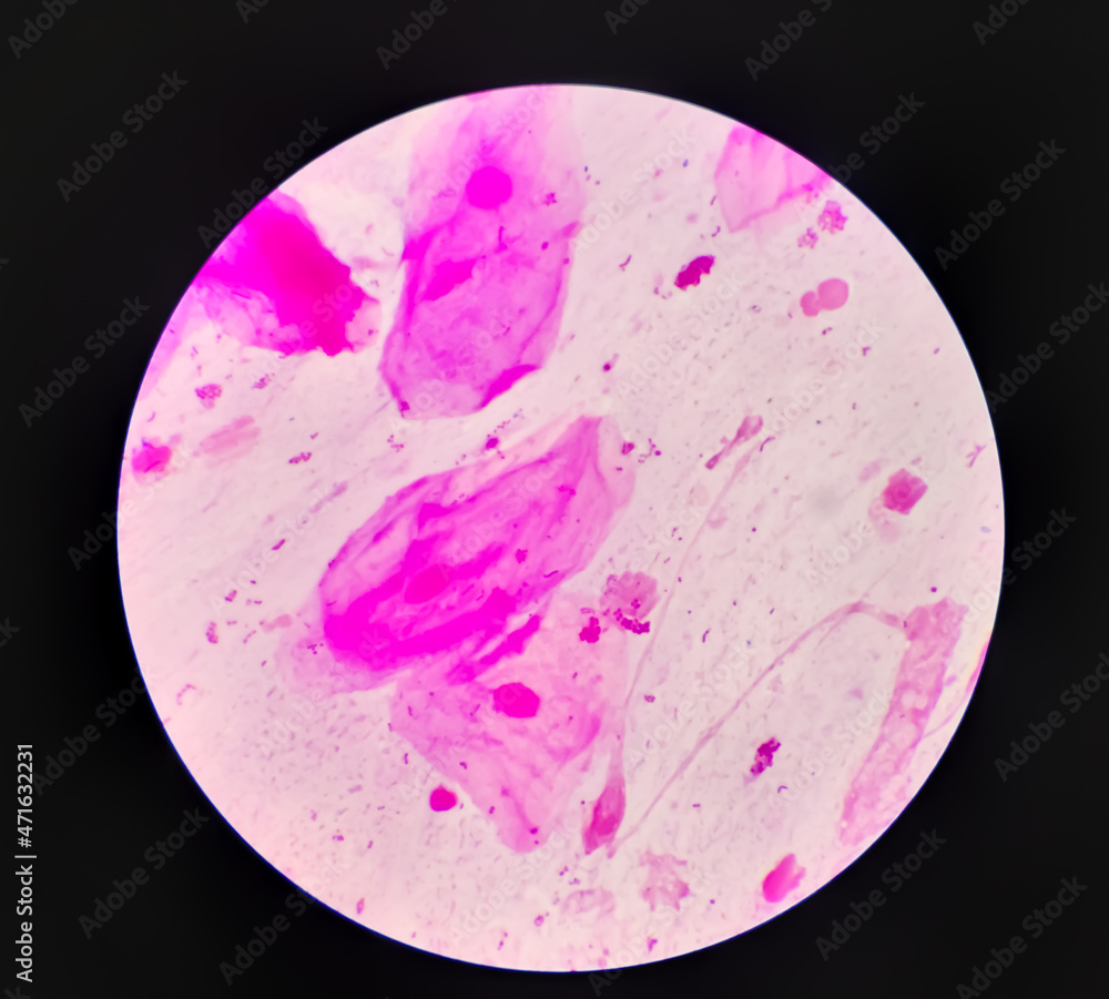 Gram stain Gram positive cocci, Gram positive diplococci bacteria