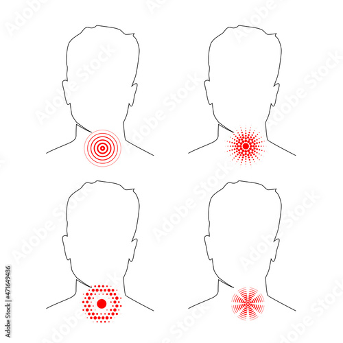 Sore throat, abstract outline human body with pain location on neck of red circle lines
