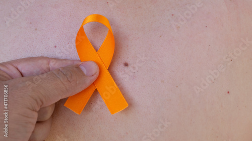December orange	. holding an orange tape over the skin with spots. campaign to prevent skin cancer, melanoma,