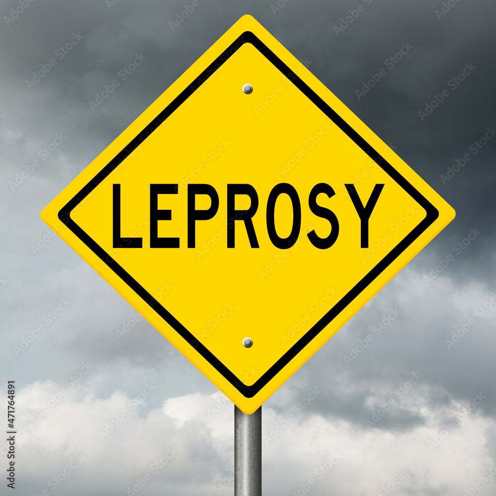 Rendering of a yellow highway sign with disease warning and black clouds in the background Rendering of a yellow highway sign with disease warning and black clouds in the background