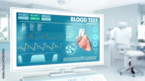 blood sample test on monitor in hi-tech hospital room - computer generated industrial 3D rendering