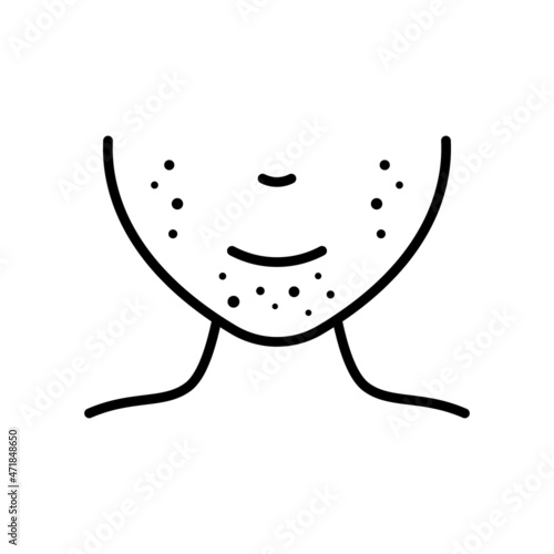 Human Face with Acne Line Icon. Chin with Pimples or Rash. Allergy, Inflammation Skin, Dermatologic Problem on Lower Face. Editable Stroke. Isolated Vector Illustration