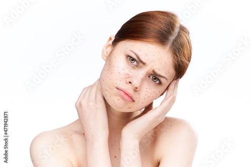 sad woman with bare shoulders red dots on her face