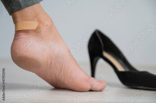 A woman in black shoes puts a plaster on a corn